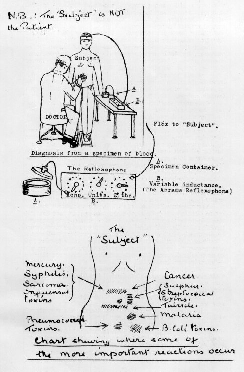 Picture of diagnosis setup and the Reflexophone-device